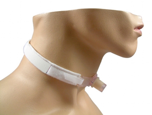 TRAQUEOSTOMIA PRECOCE PODE SER BENÉFICA EM CRIANÇAS E ADULTOS INTERNADOS EM UTI TRAQUEOSTOMIA PRECOCE PODE SER BENÉFICA EM CRIANÇAS E ADULTOS INTERNADOS EM UTI